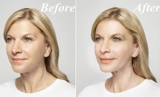 Before and after using Cream Goji